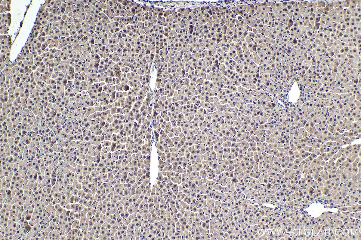IHC staining of rat liver using 10305-1-AP