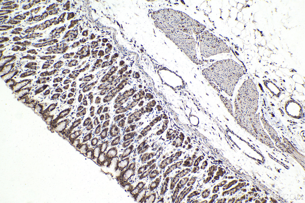 IHC staining of rat stomach using 10305-1-AP