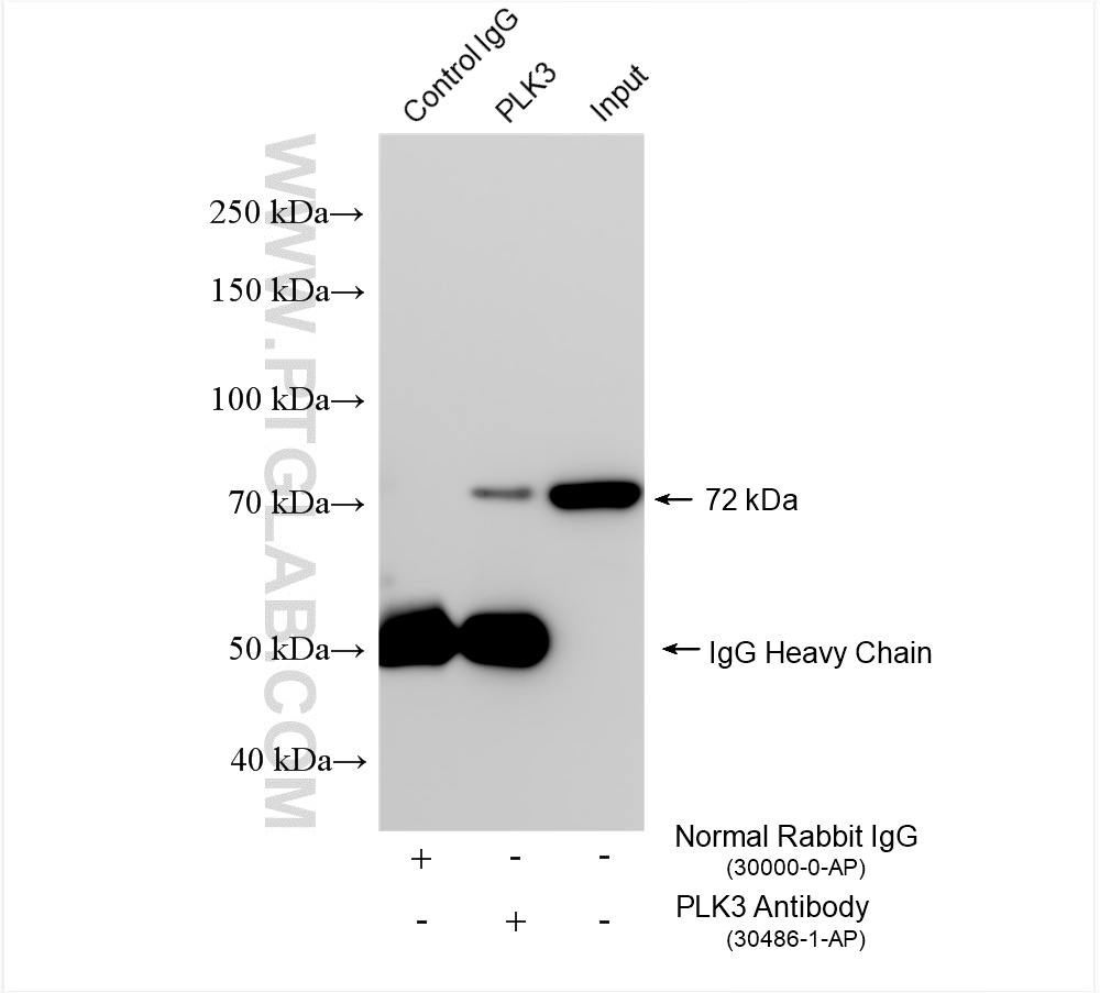IP experiment of HeLa using 30486-1-AP