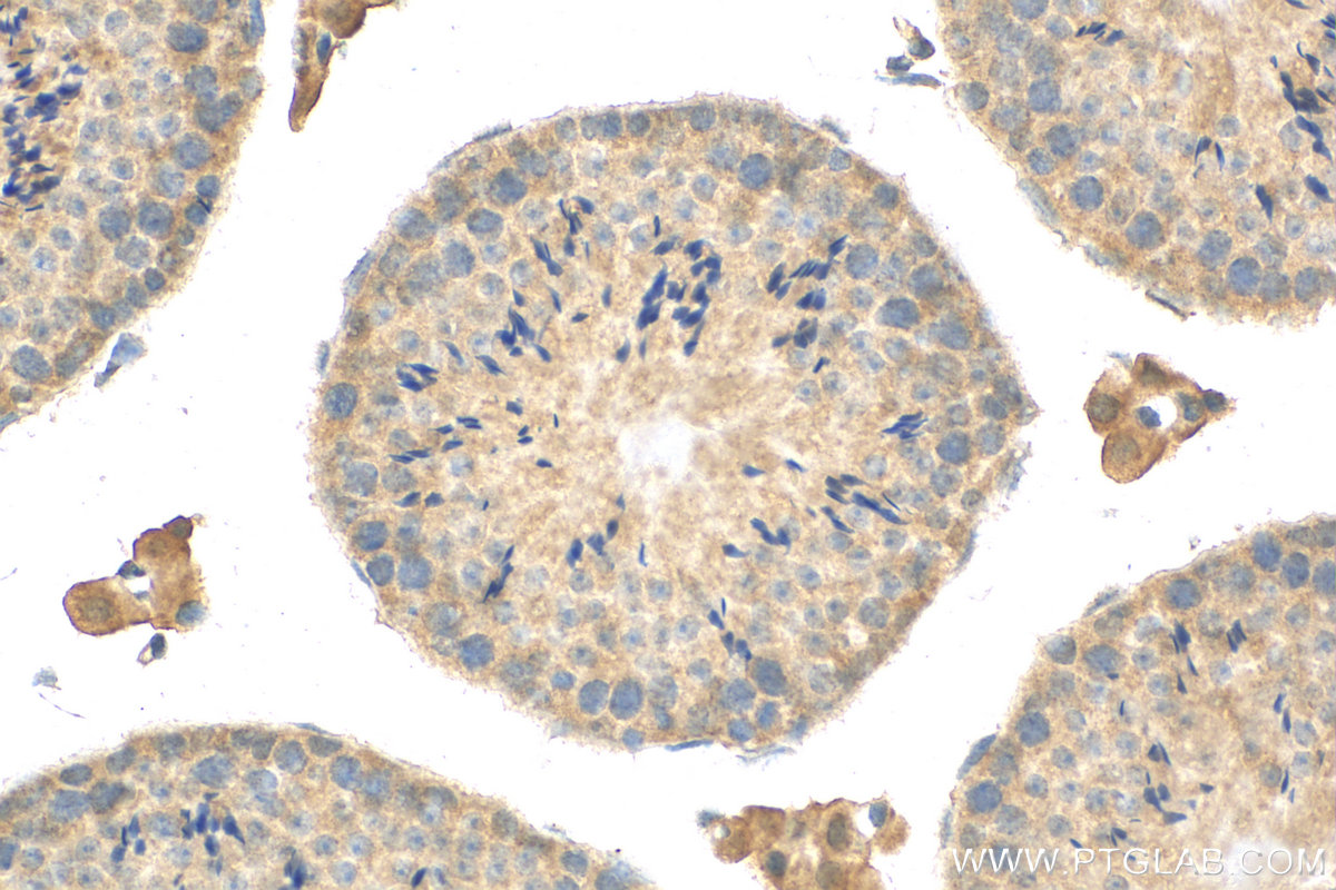 IHC staining of mouse testis using 12952-1-AP