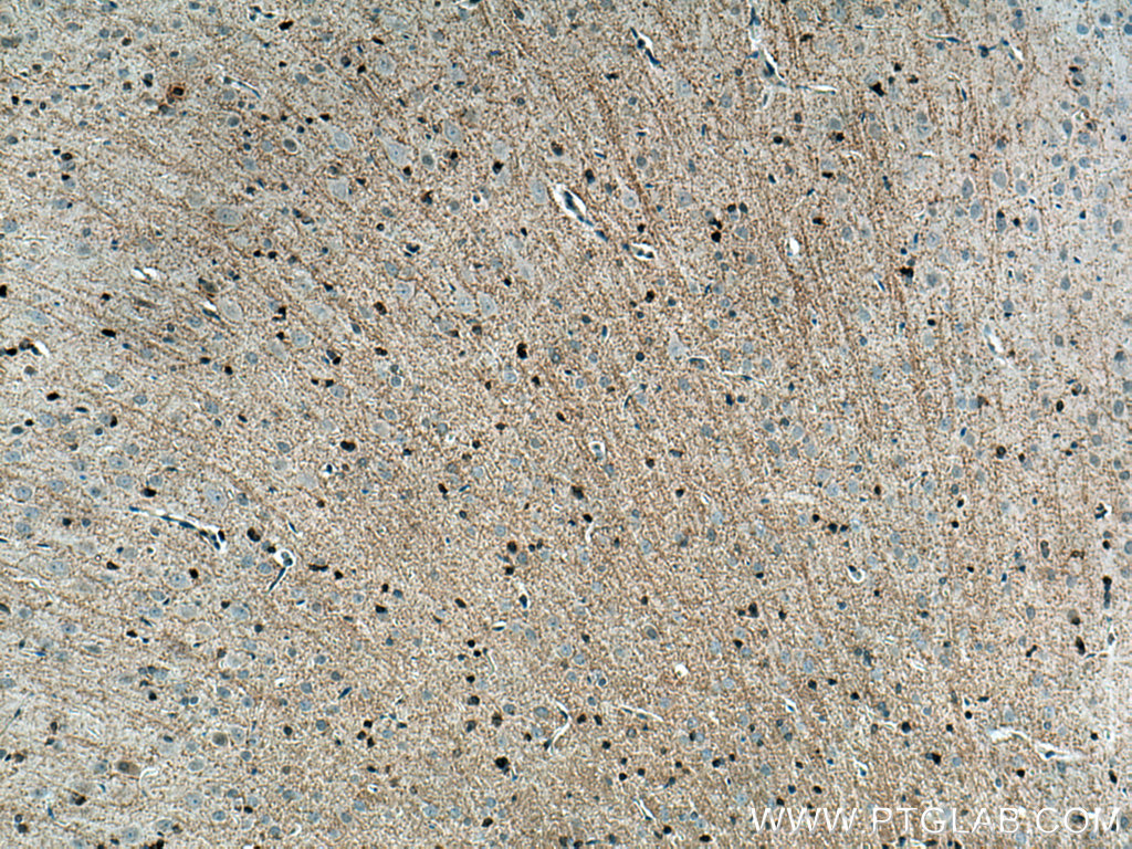 IHC staining of rat brain using 14868-1-AP