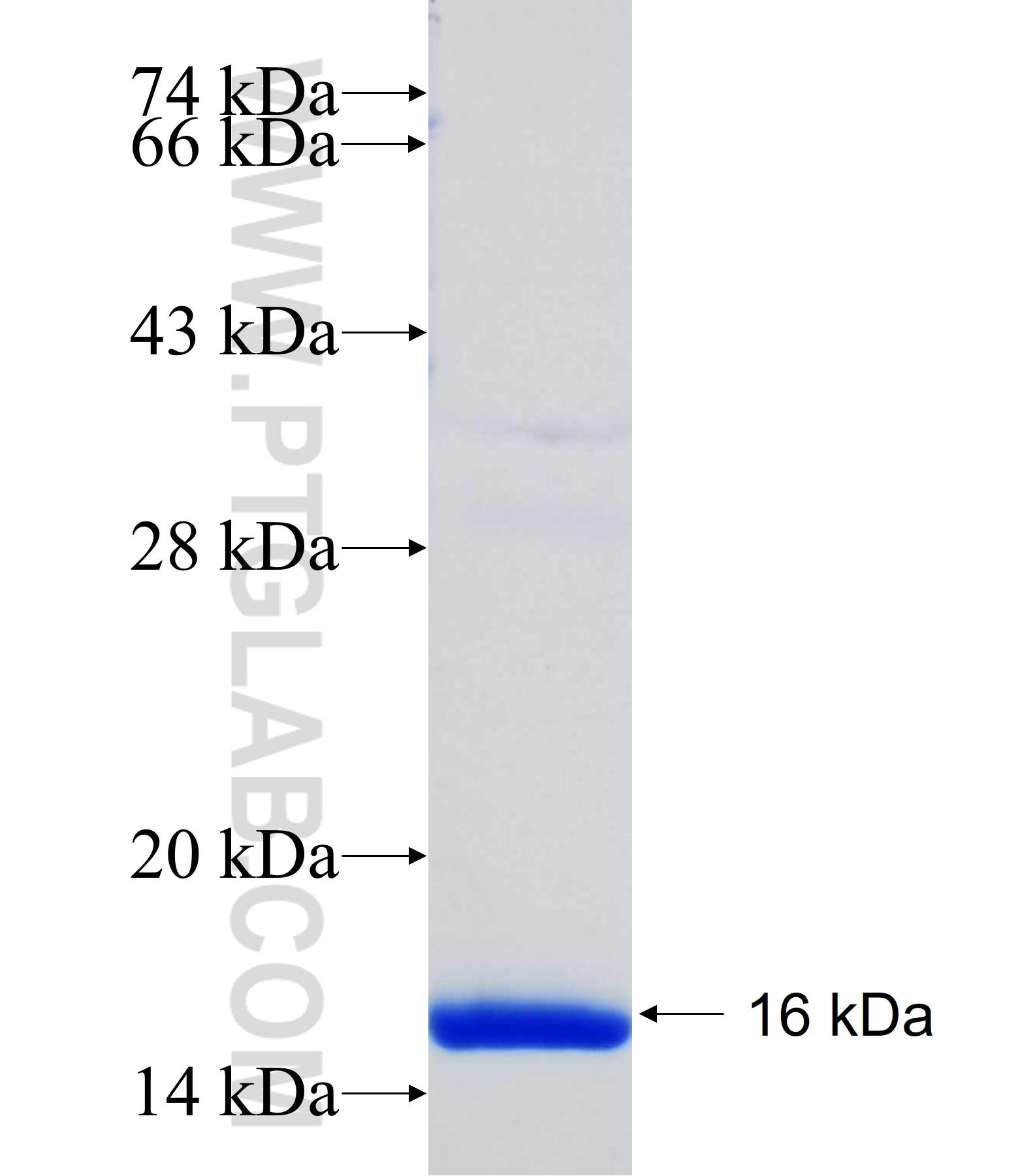 PLOD1 fusion protein Ag31634 SDS-PAGE