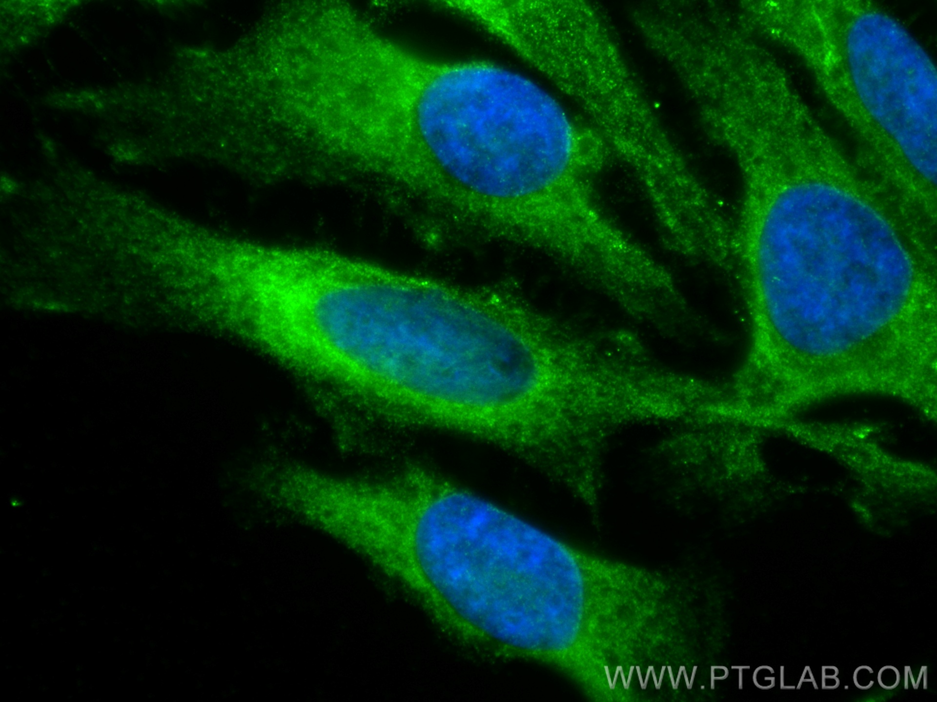 IF Staining of HeLa using 21214-1-AP