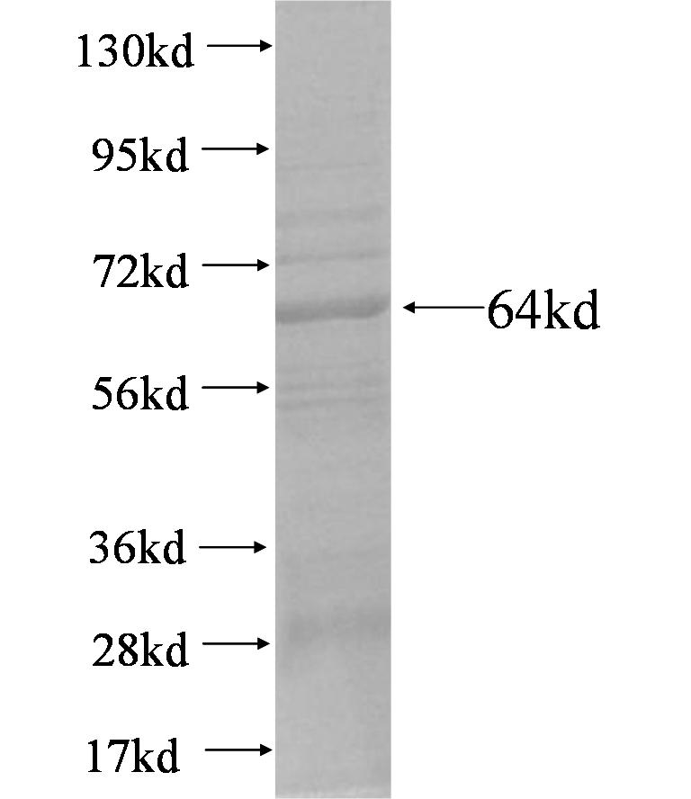 PLOD2 fusion protein Ag4300 SDS-PAGE