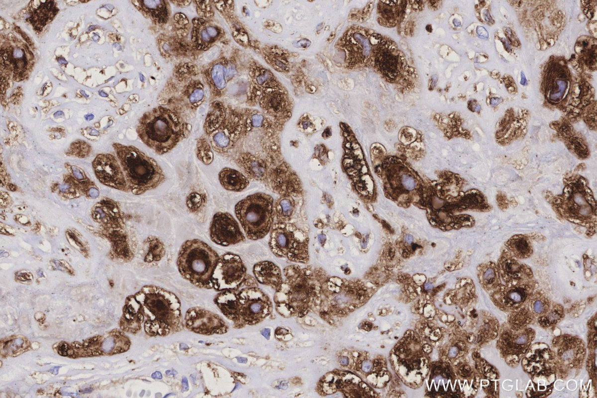 IHC staining of human placenta using 11027-1-AP IHC staining of human placenta using 11027-1-AP