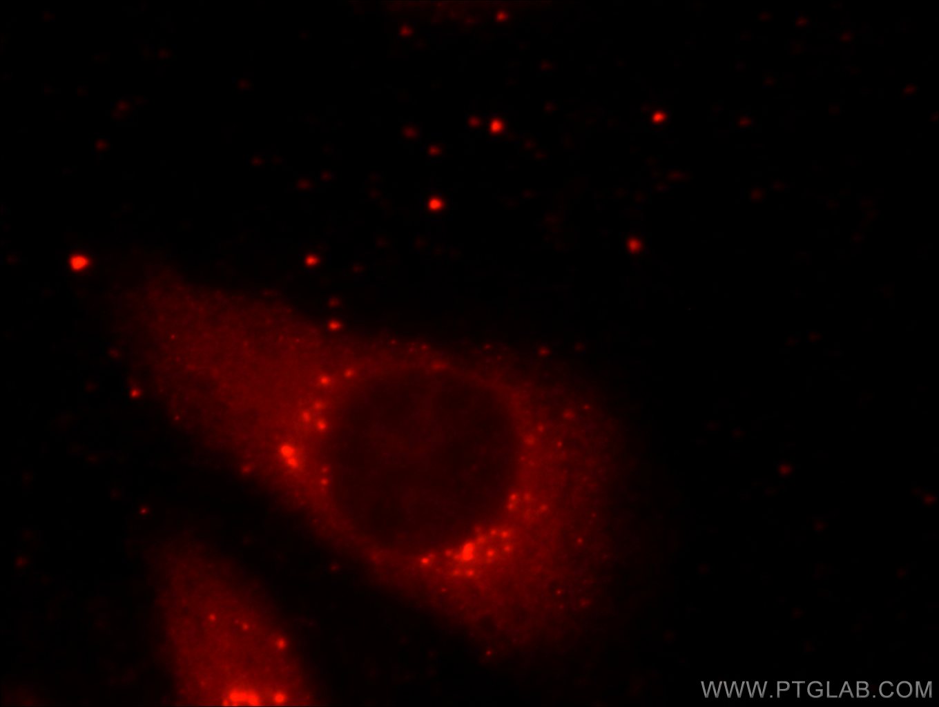 PLOD3 Monoclonal antibody