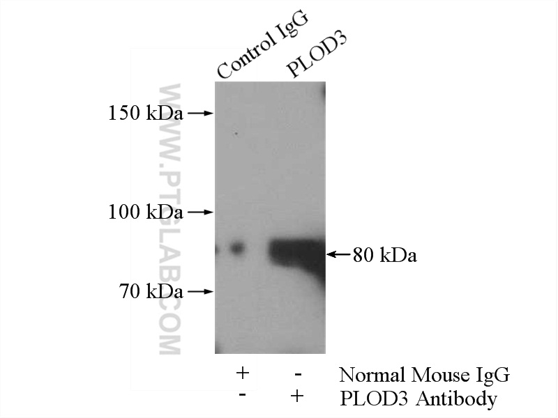 IP experiment of HeLa using 60058-1-Ig