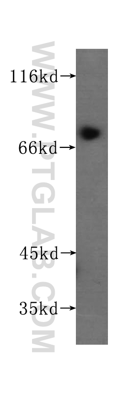WB analysis of human placenta using 60058-1-Ig (same clone as 60058-1-PBS)
