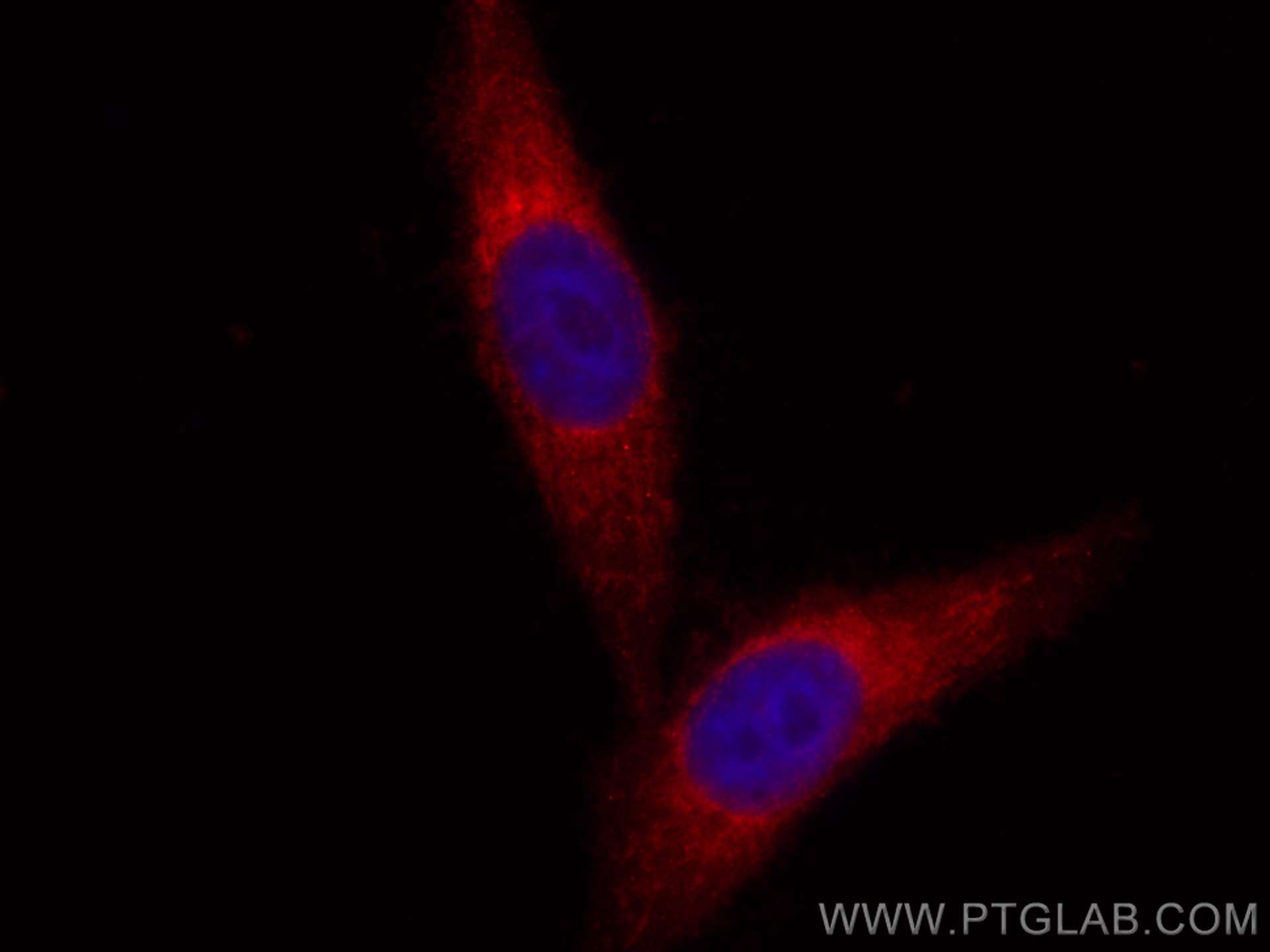 IF Staining of HepG2 using CL594-11027