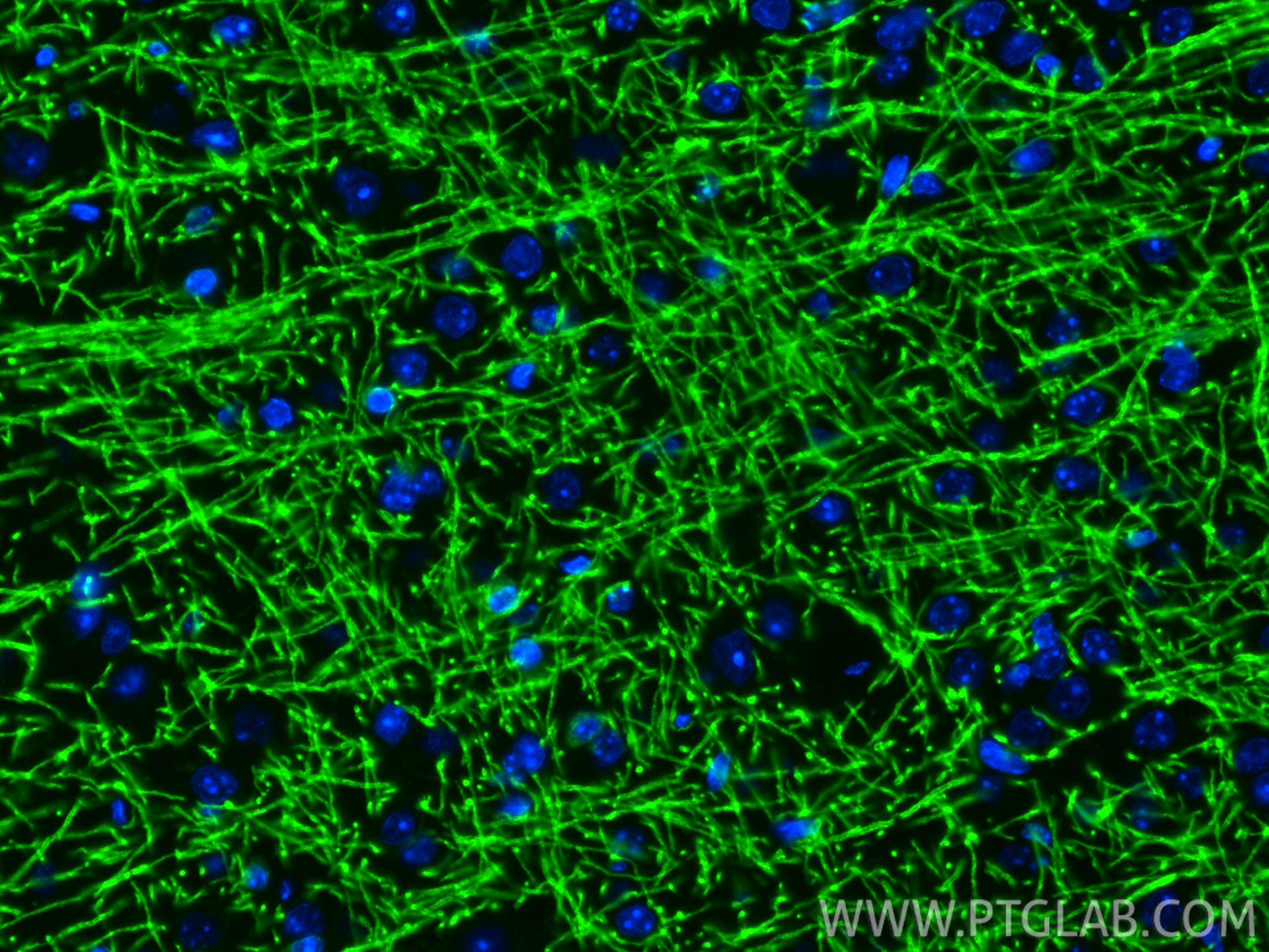IF Staining of mouse brain using 33901-1-AP