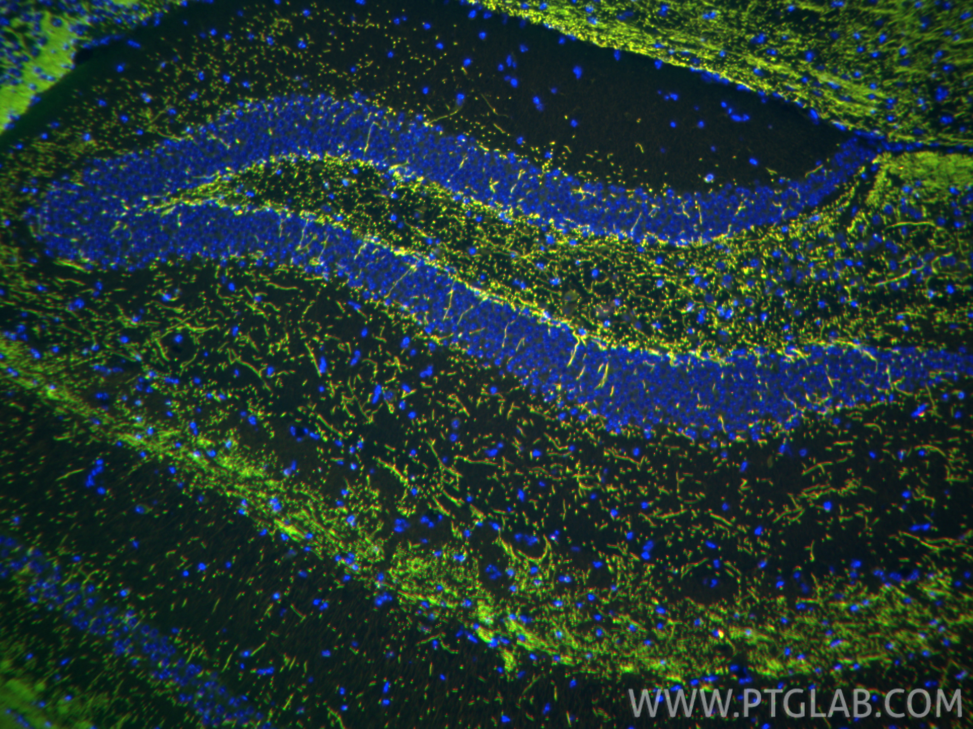 IF Staining of mouse brain using 33901-1-AP