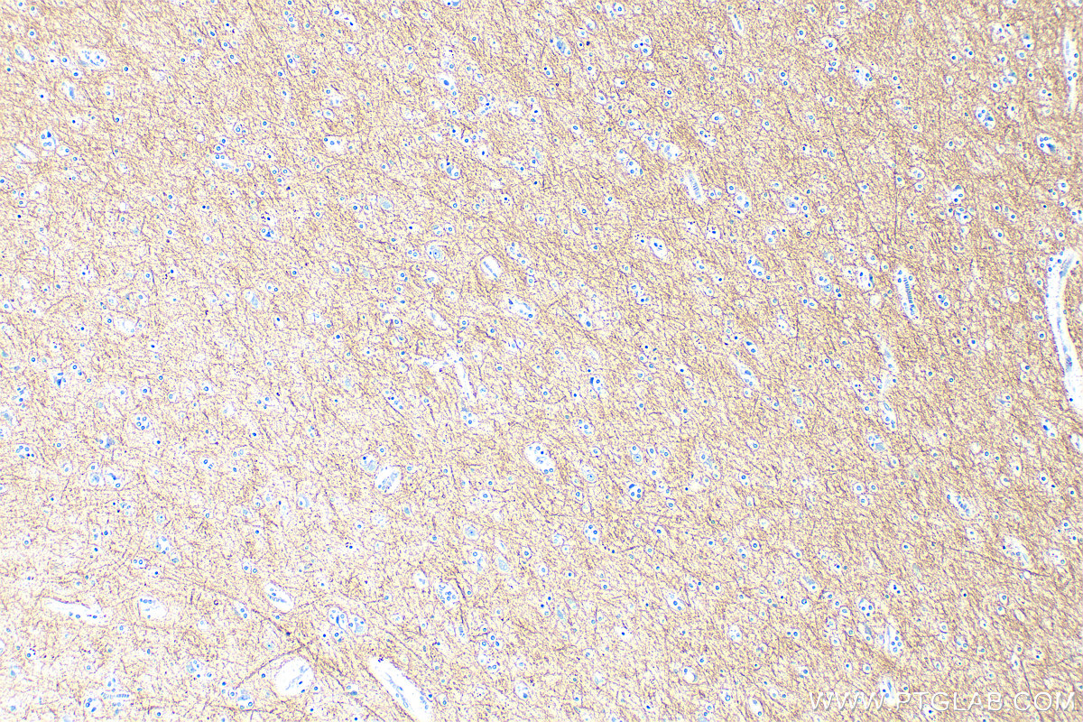 IHC staining of human brain using 33901-1-AP
