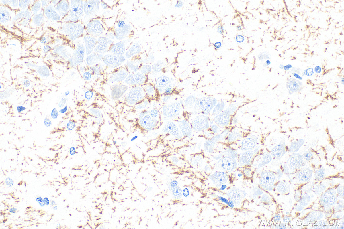 IHC staining of rat brain using 33901-1-AP