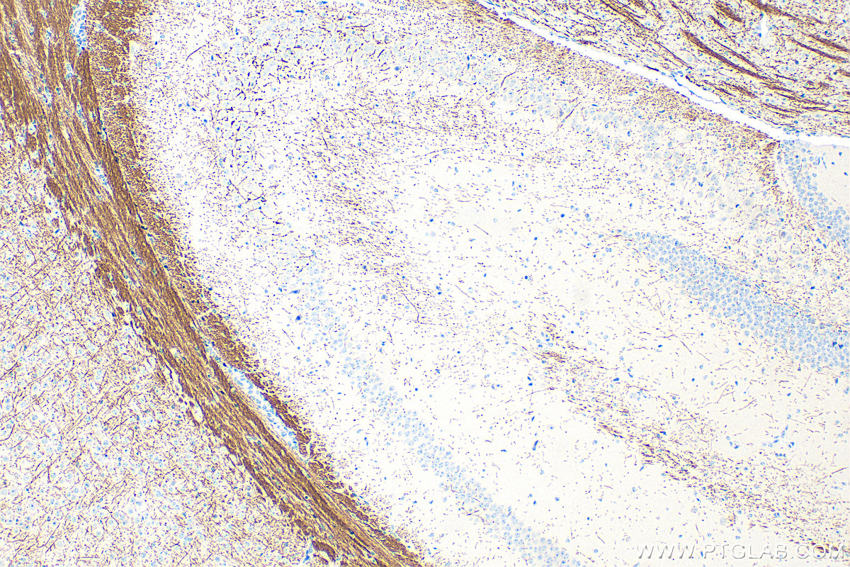 IHC staining of mouse brain using 33901-1-AP
