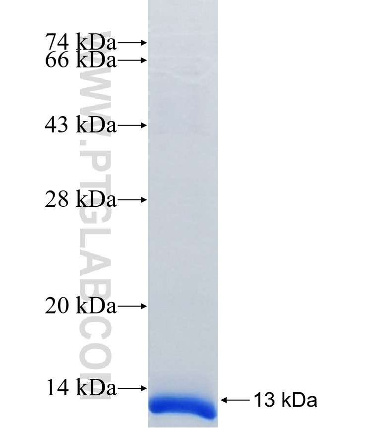 PLP1 fusion protein Ag38746 SDS-PAGE PLP1 fusion protein Ag38746 SDS-PAGE