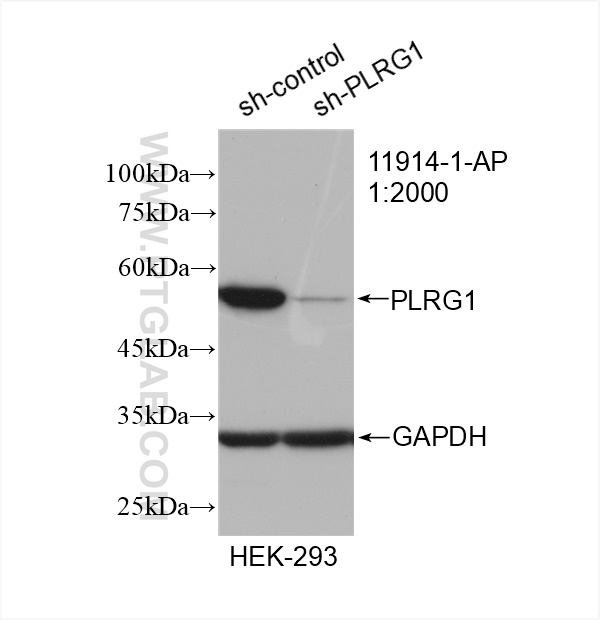 WB analysis of HEK-293 using 11914-1-AP