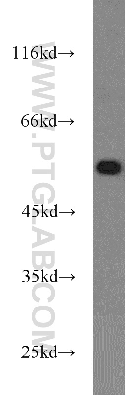 WB analysis of K-562 using 11914-1-AP