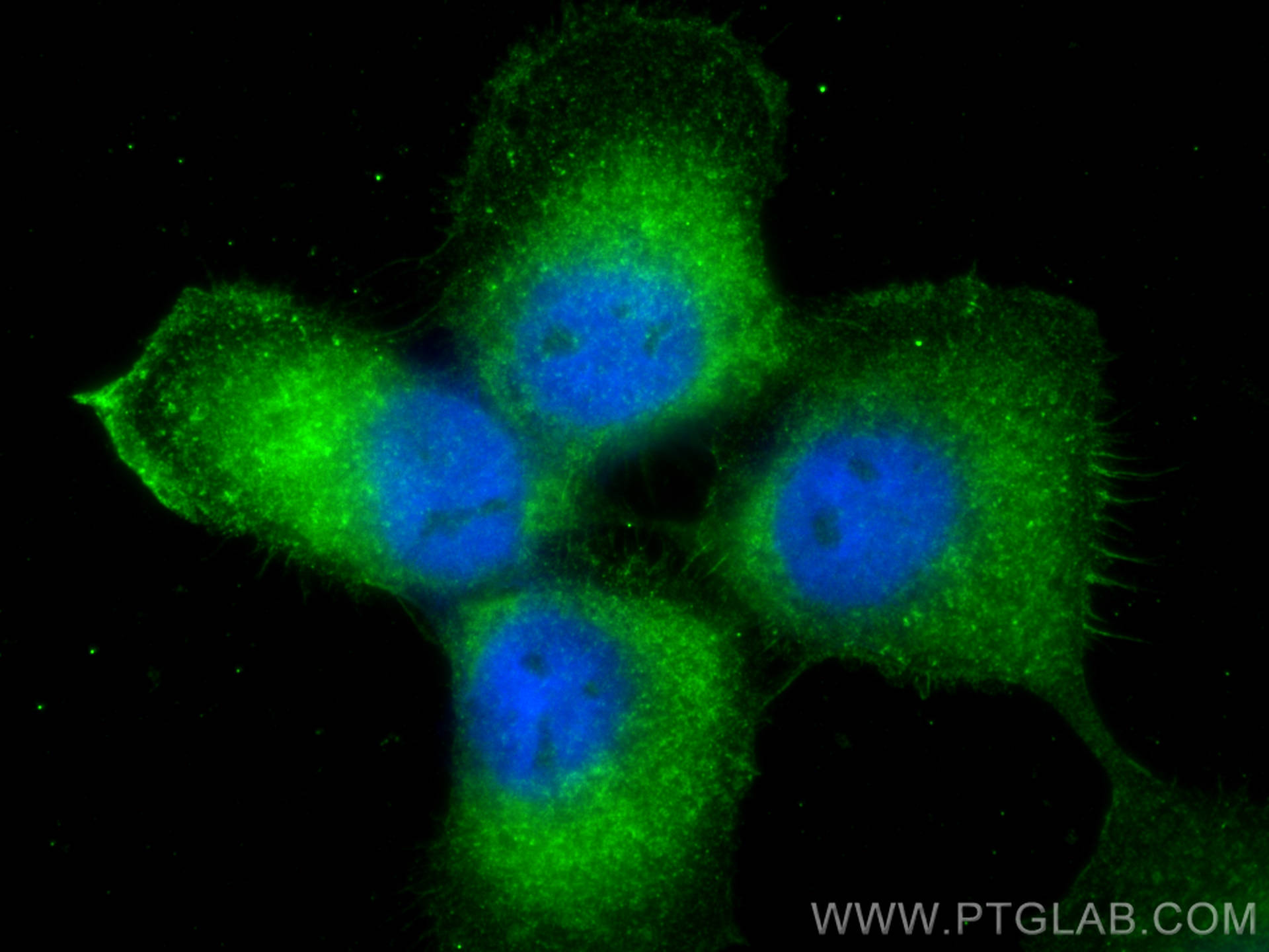 IF Staining of A431 using 12917-1-AP