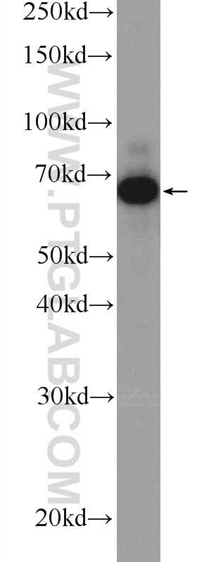 WB analysis of A431 using 12917-1-AP