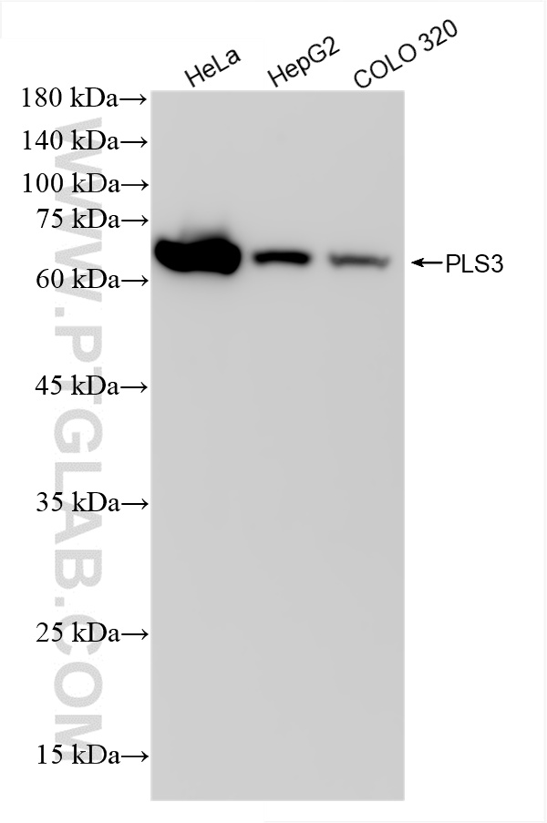WB analysis using 86323-1-RR