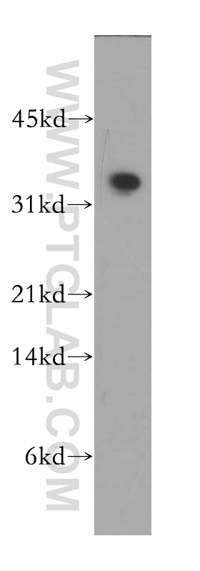 WB analysis of human heart using 12630-1-AP