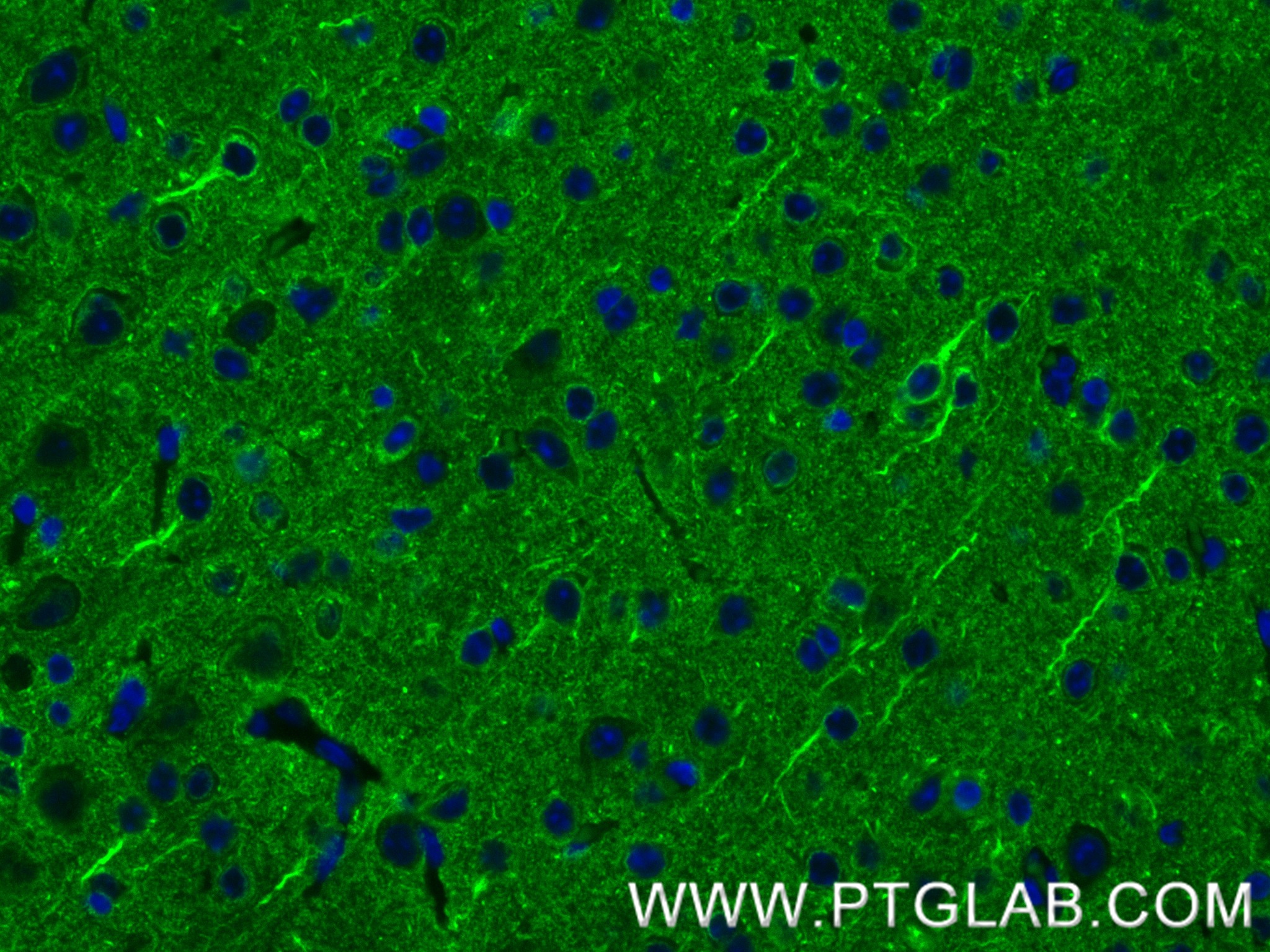 IF Staining of mouse brain using 84592-1-RR