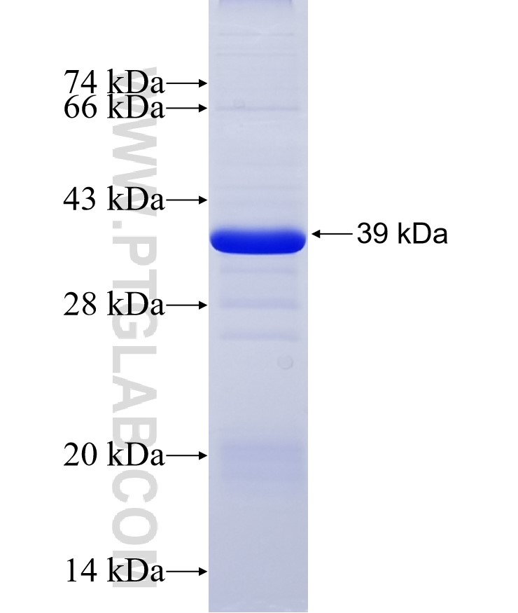 PLTP fusion protein Ag5644 SDS-PAGE PLTP fusion protein Ag5644 SDS-PAGE