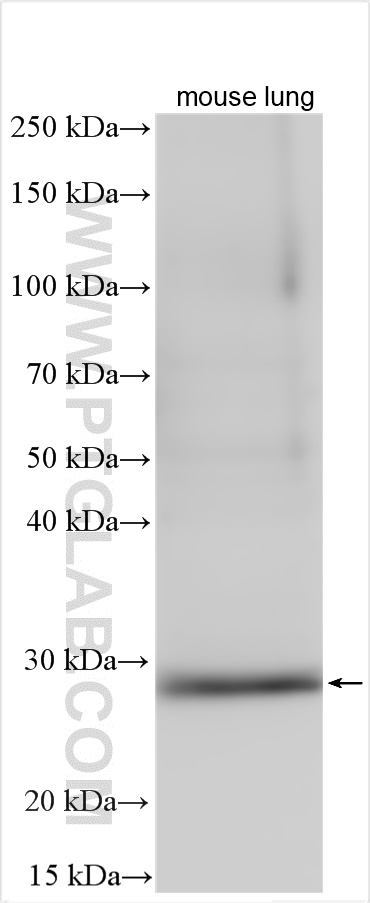 WB analysis of mouse lung using 10413-1-AP