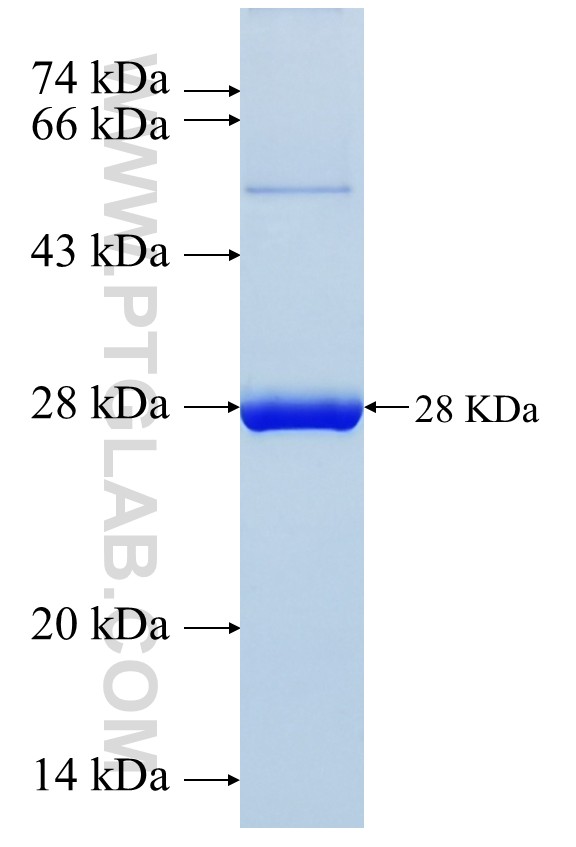 PLUNC fusion protein Ag17724 SDS-PAGE PLUNC fusion protein Ag17724 SDS-PAGE