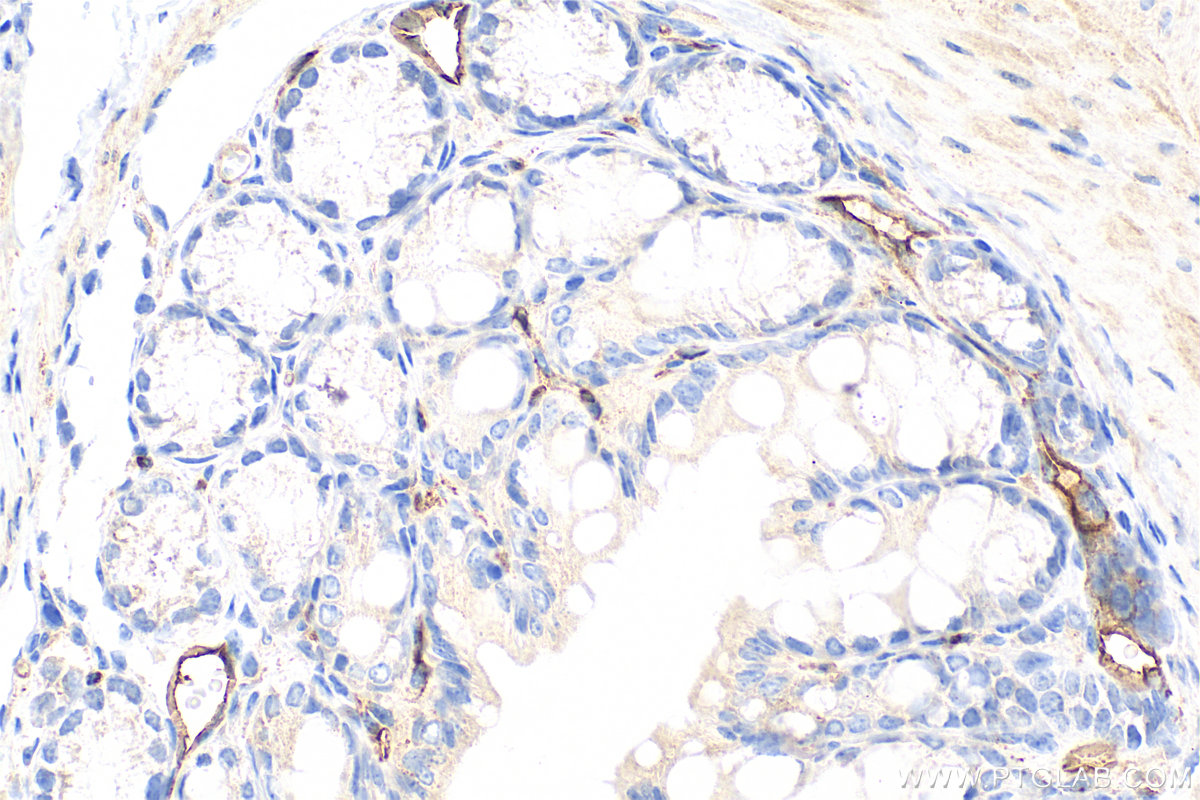 IHC staining of mouse colon using 14452-1-AP