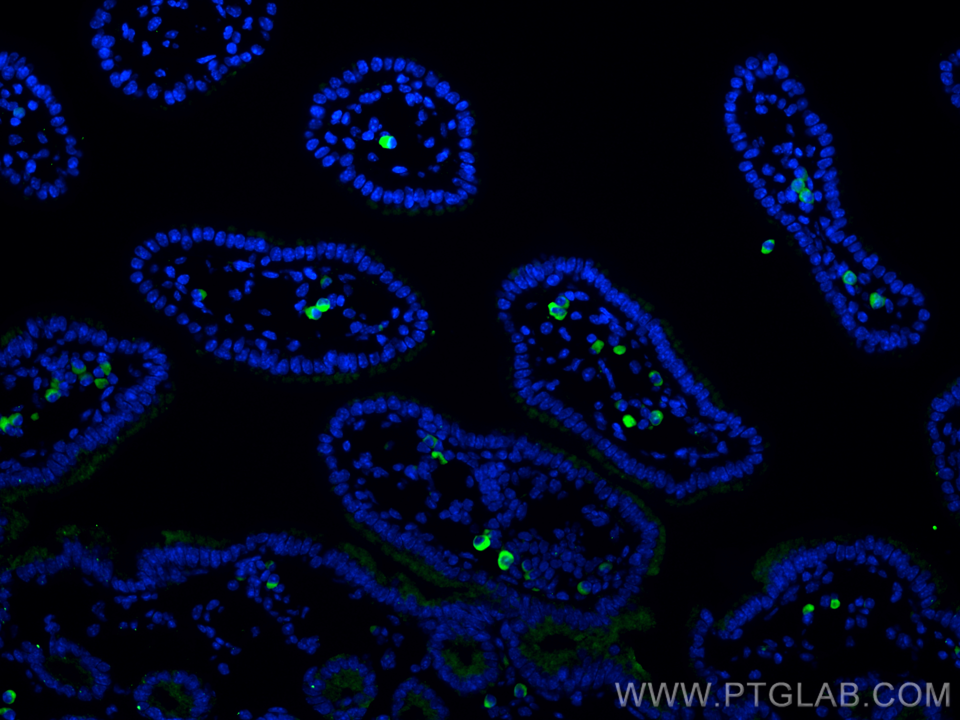 IF Staining of mouse small intestine using 67158-1-Ig (same clone as 67158-1-PBS)