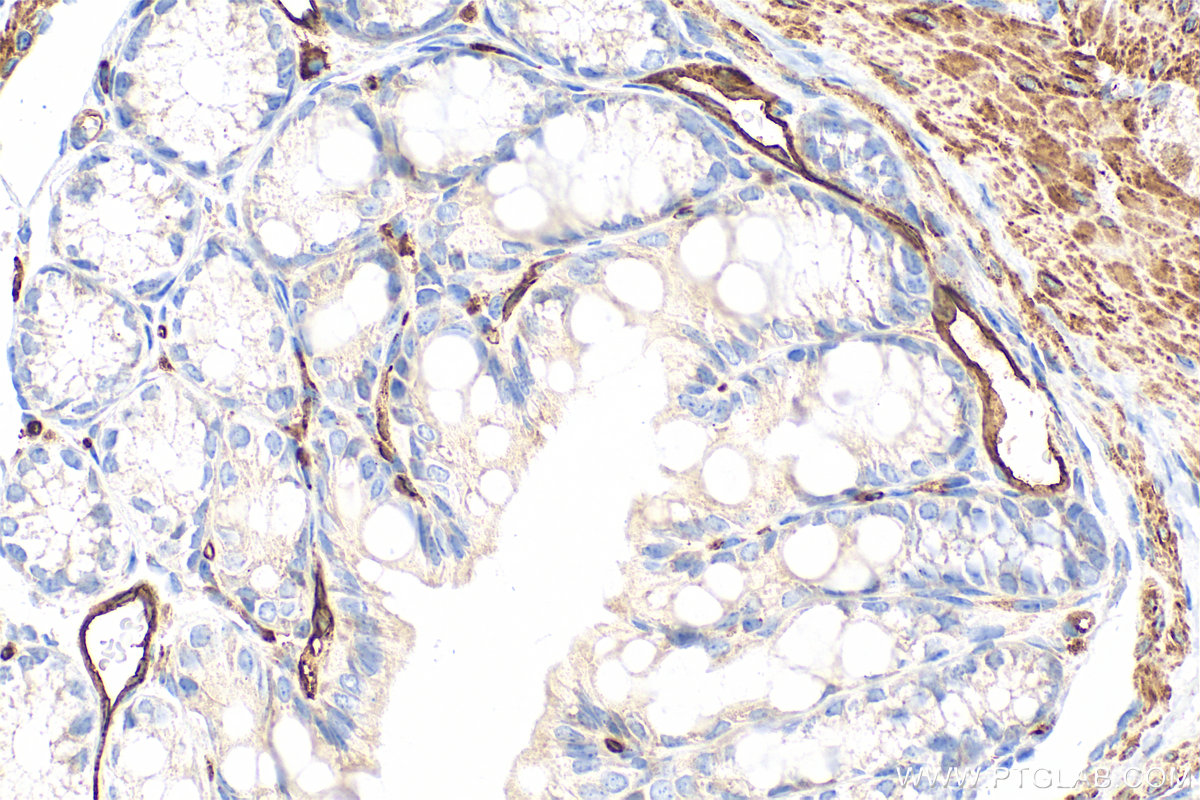 IHC staining of mouse colon using 87712-1-RR IHC staining of mouse colon using 87712-1-RR