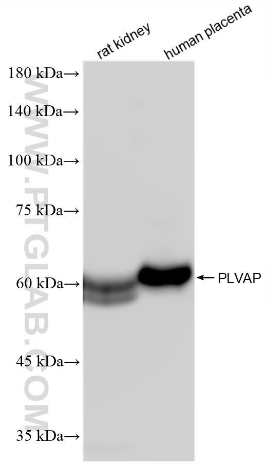 WB analysis using 87712-1-RR WB analysis using 87712-1-RR