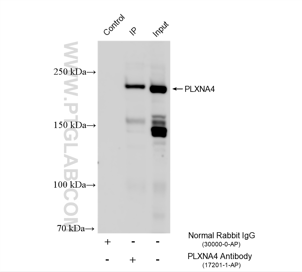 IP result of anti-PLXNA4 (IP:17201-1-AP, 4ug; Detection:17201-1-AP 1:800) with mouse brain tissue lysate 1720 ug. IP experiment of mouse brain using 17201-1-AP