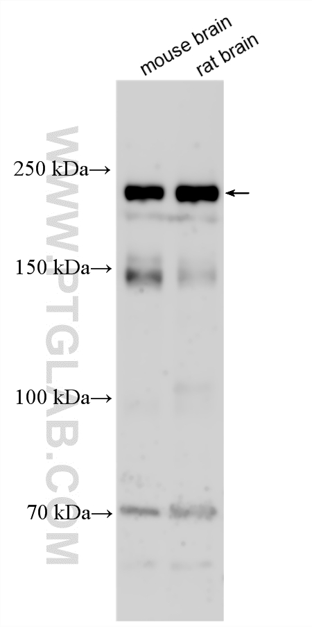 Various lysates were subjected to SDS PAGE followed by western blot with 17201-1-AP (PLXNA4 antibody) at dilution of 1:4000 incubated at room temperature for 1.5 hours. WB analysis using 17201-1-AP