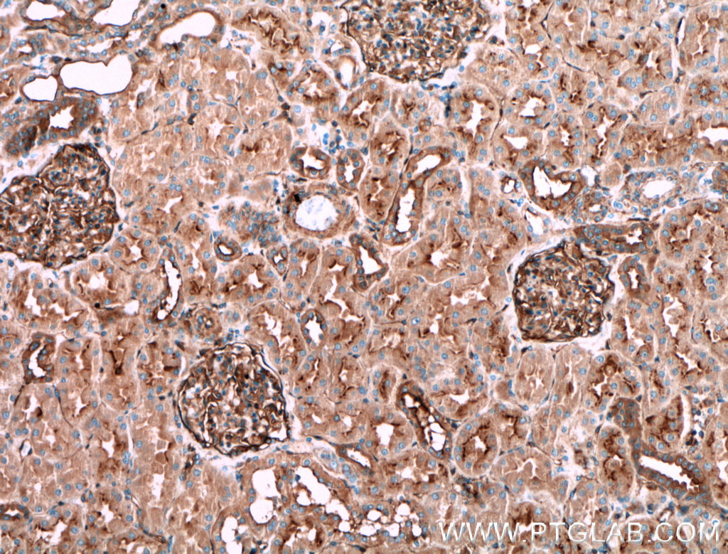 IHC staining of human kidney using 23795-1-AP