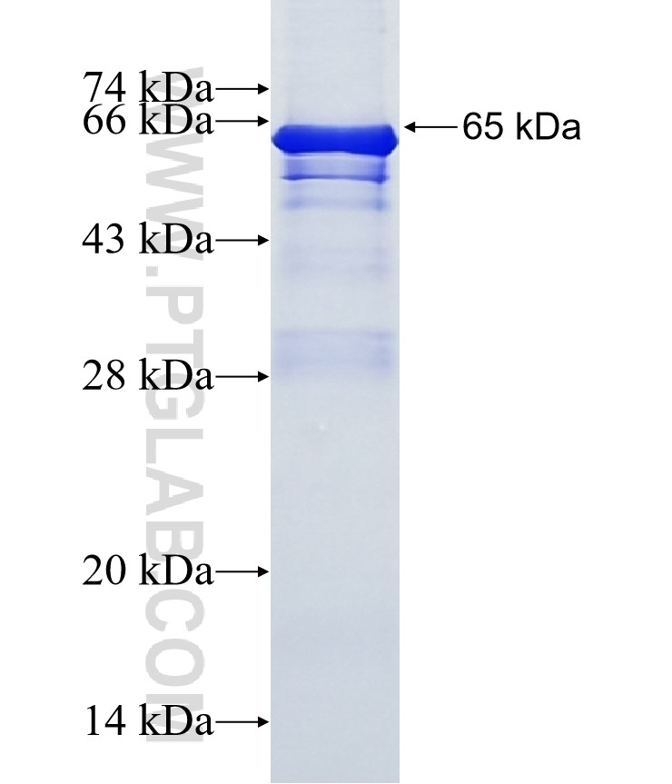 PLXNB1 fusion protein Ag16262 SDS-PAGE PLXNB1 fusion protein Ag16262 SDS-PAGE