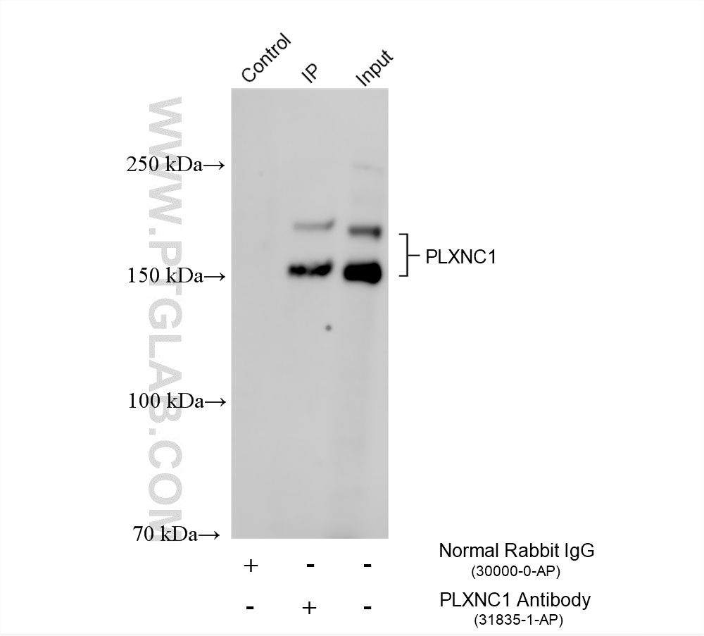 IP experiment of mouse brain using 31835-1-AP