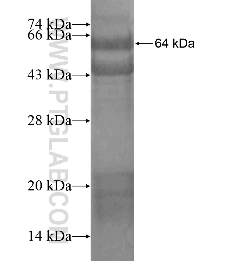 PLXNC1 fusion protein Ag18225 SDS-PAGE PLXNC1 fusion protein Ag18225 SDS-PAGE