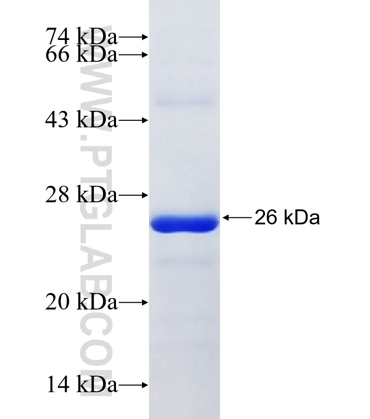 PM20D1 fusion protein Ag29171 SDS-PAGE PM20D1 fusion protein Ag29171 SDS-PAGE