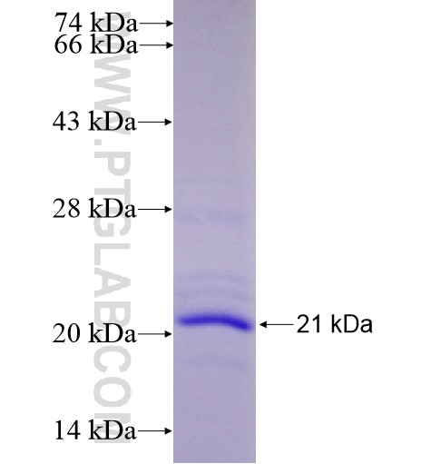 NOXA fusion protein Ag11733 SDS-PAGE NOXA fusion protein Ag11733 SDS-PAGE