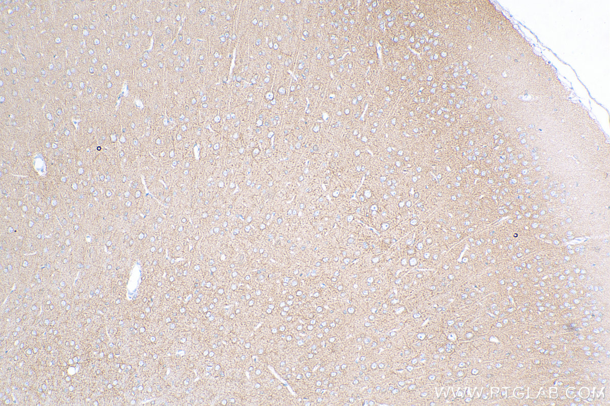 IHC staining of rat brain using 28423-1-AP