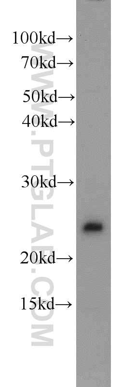 WB analysis of Jurkat using 11190-2-AP