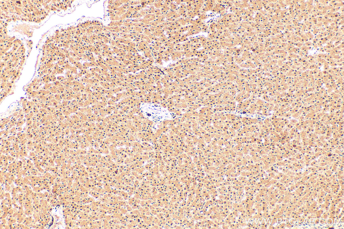 IHC staining of human liver using 21041-1-AP