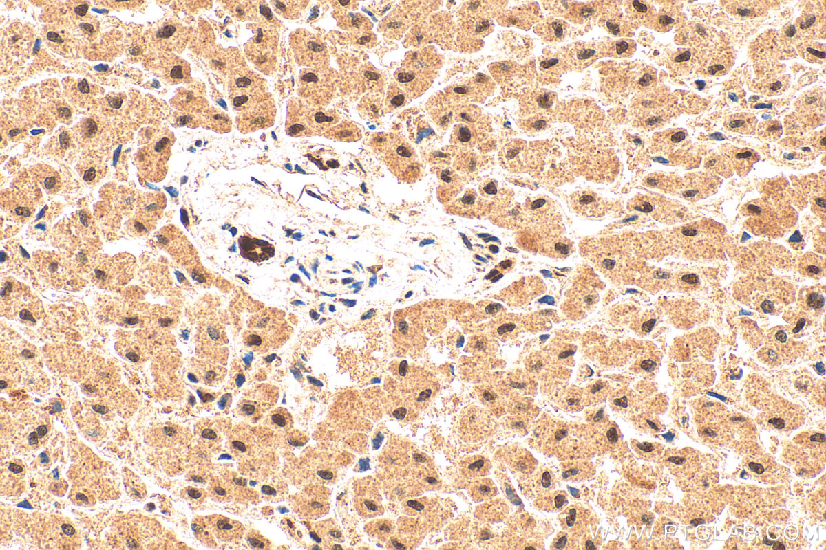 IHC staining of human liver using 21041-1-AP