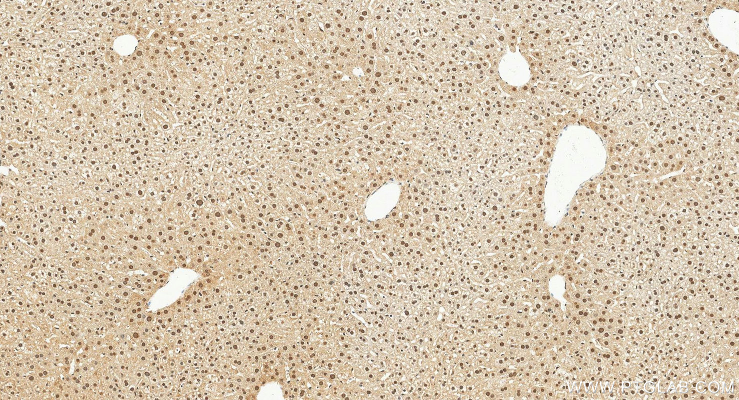 IHC staining of mouse liver using 21041-1-AP