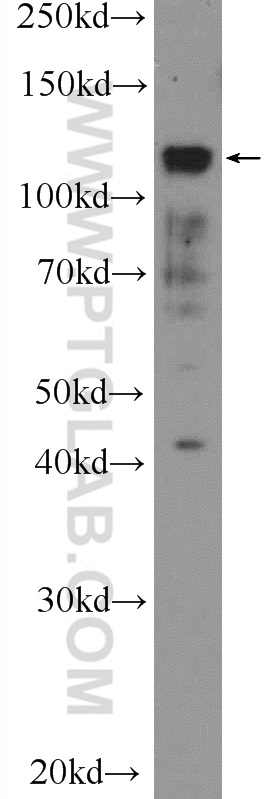 WB analysis of HEK-293 using 21041-1-AP