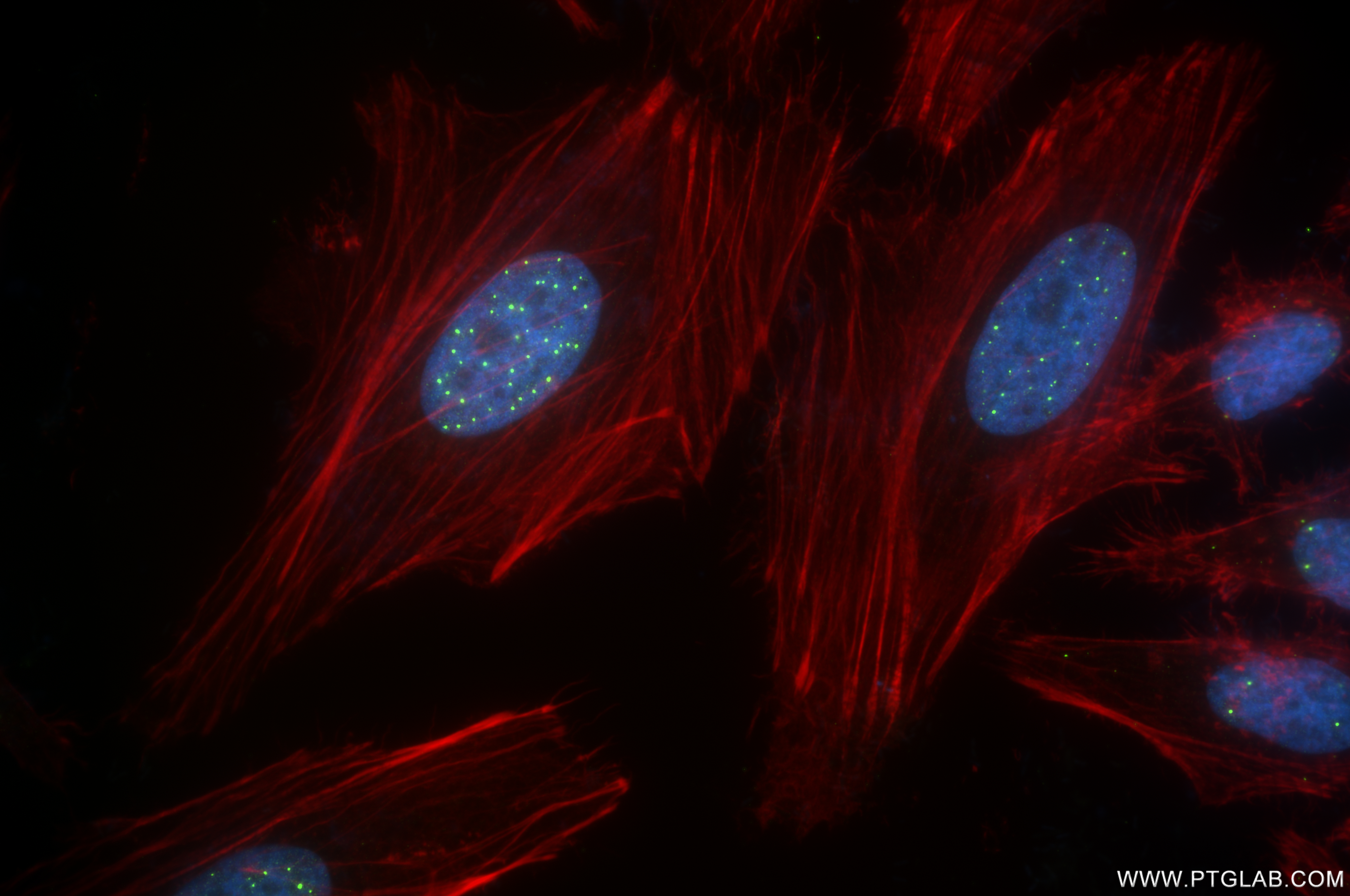 IF Staining of HeLa using 85048-5-RR (same clone as 85048-5-PBS)
