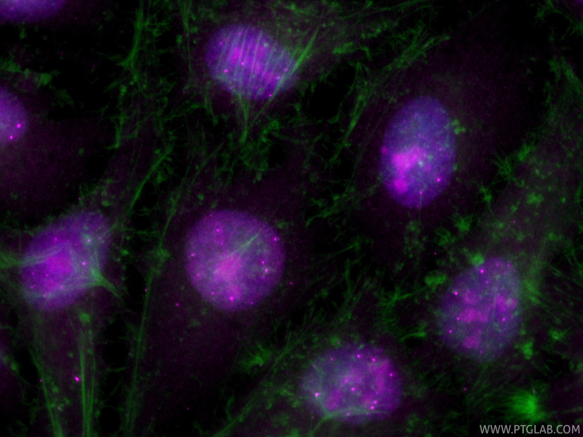 IF Staining of HeLa using CL647-85048-5