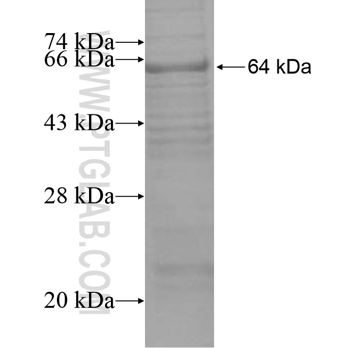 PML fusion protein Ag15377 SDS-PAGE